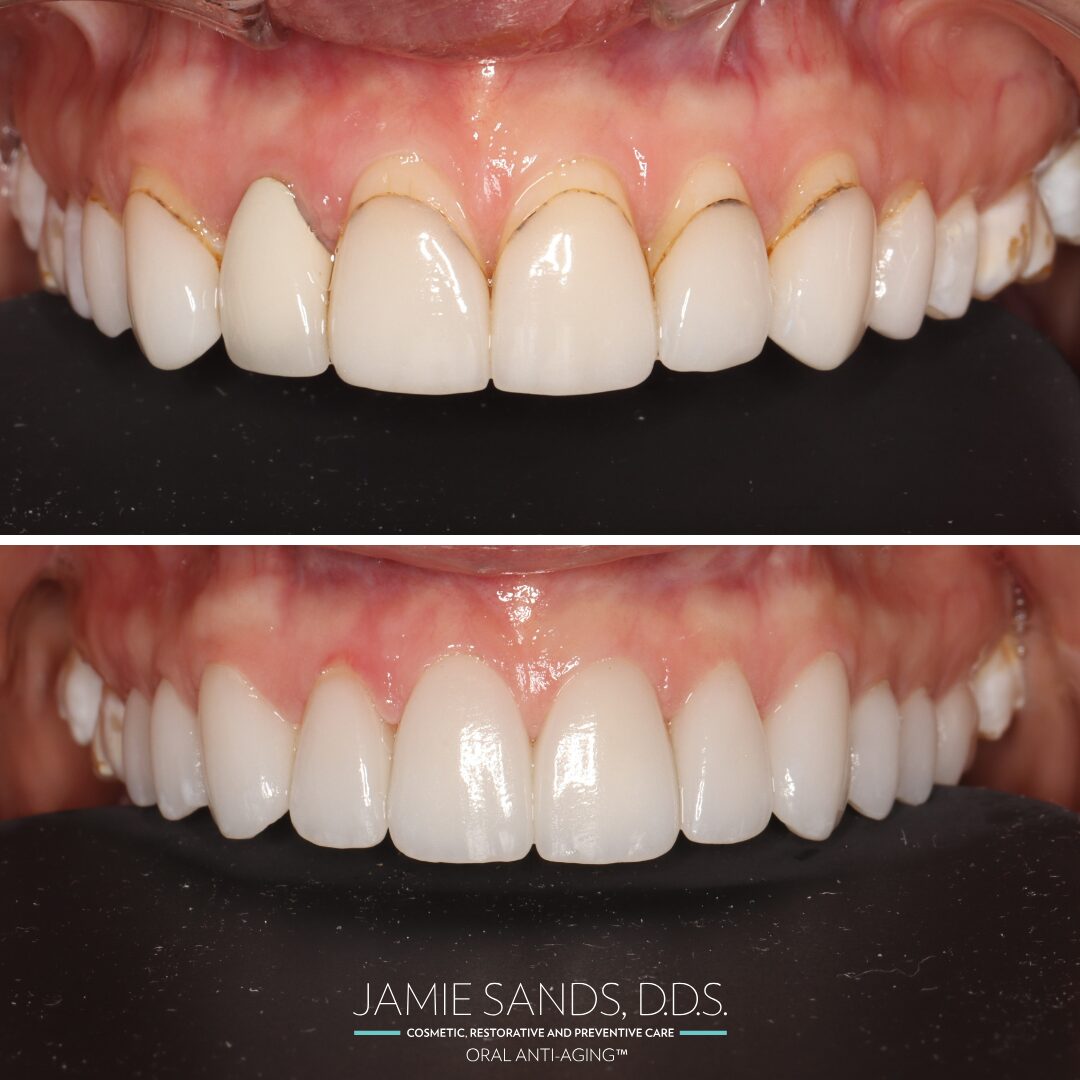 before-after-05