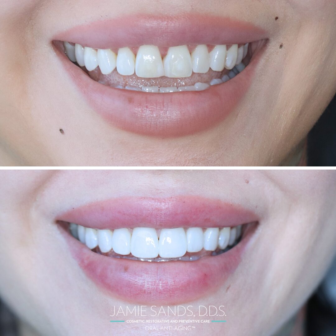 before-after-07