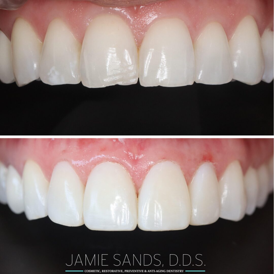 before-after-11