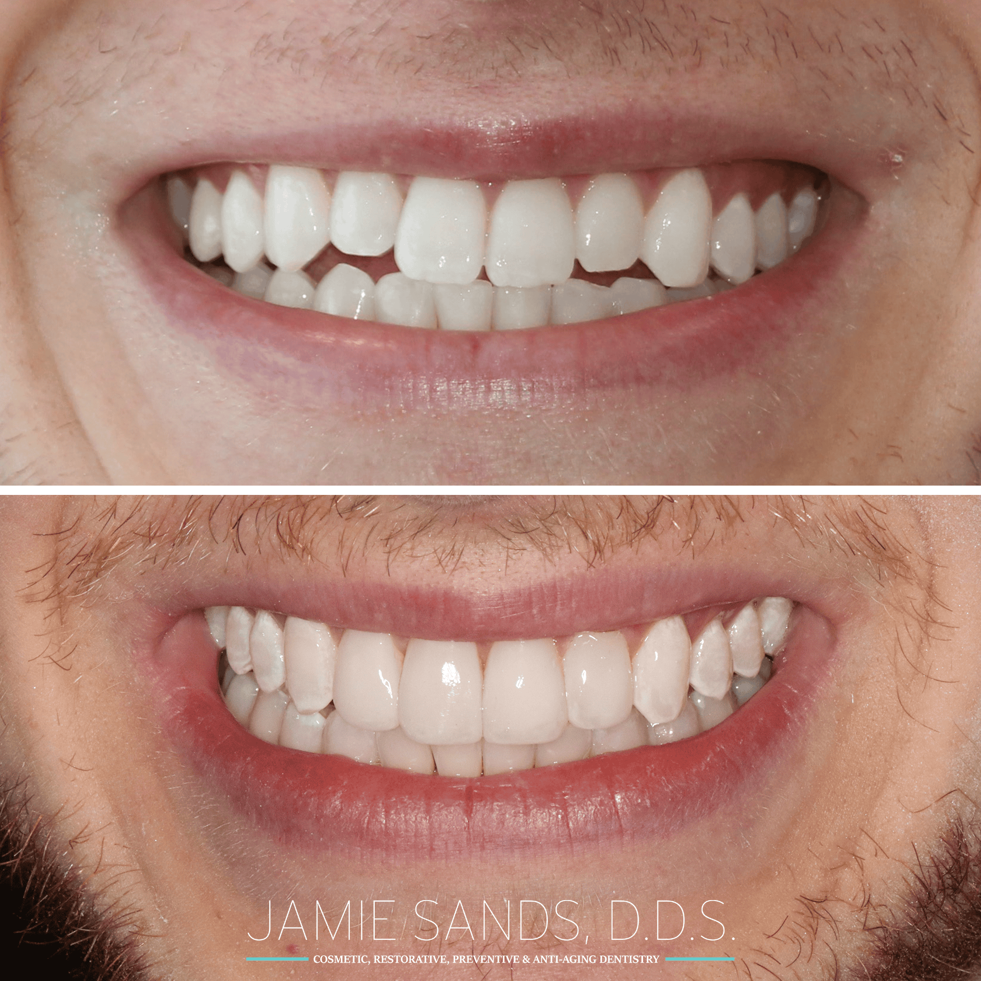 before-after-12