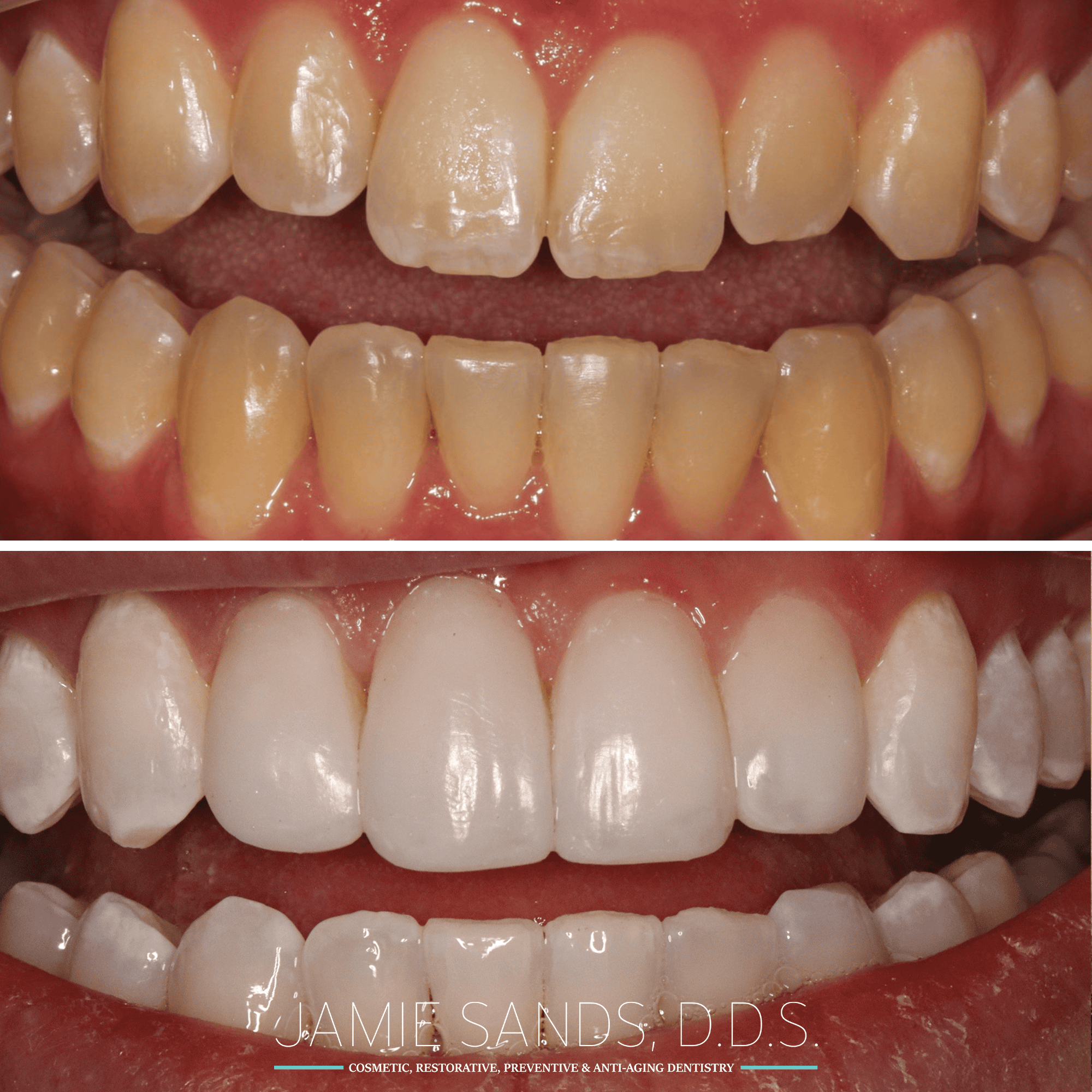 before-after-13