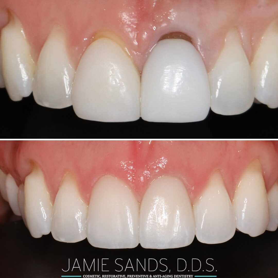 before-after-16