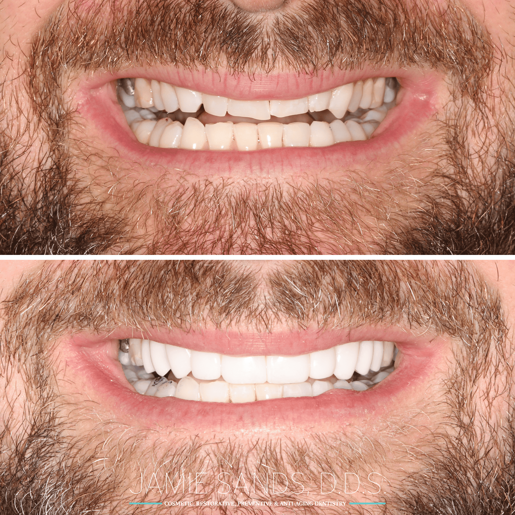 before-after-18