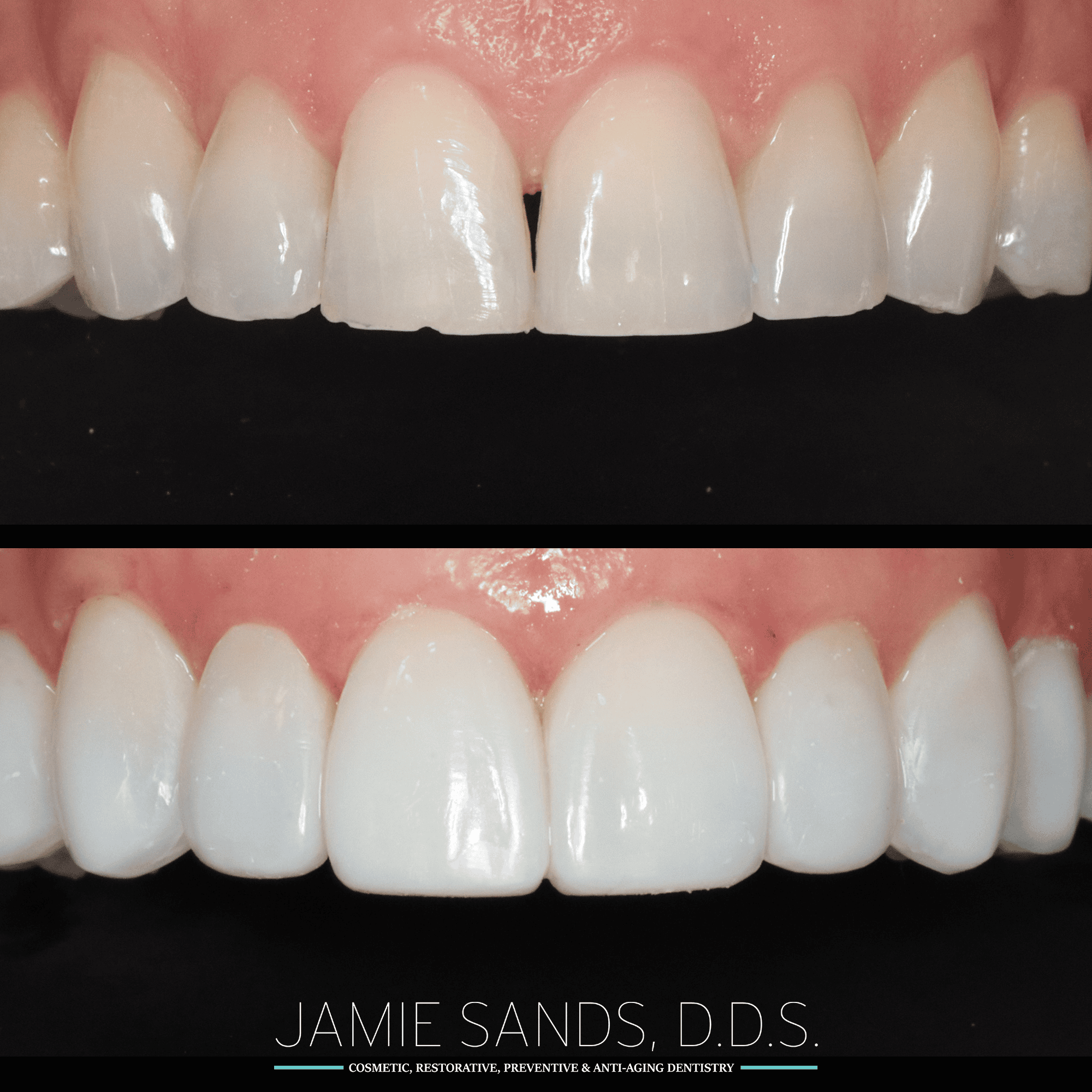 before-after-21