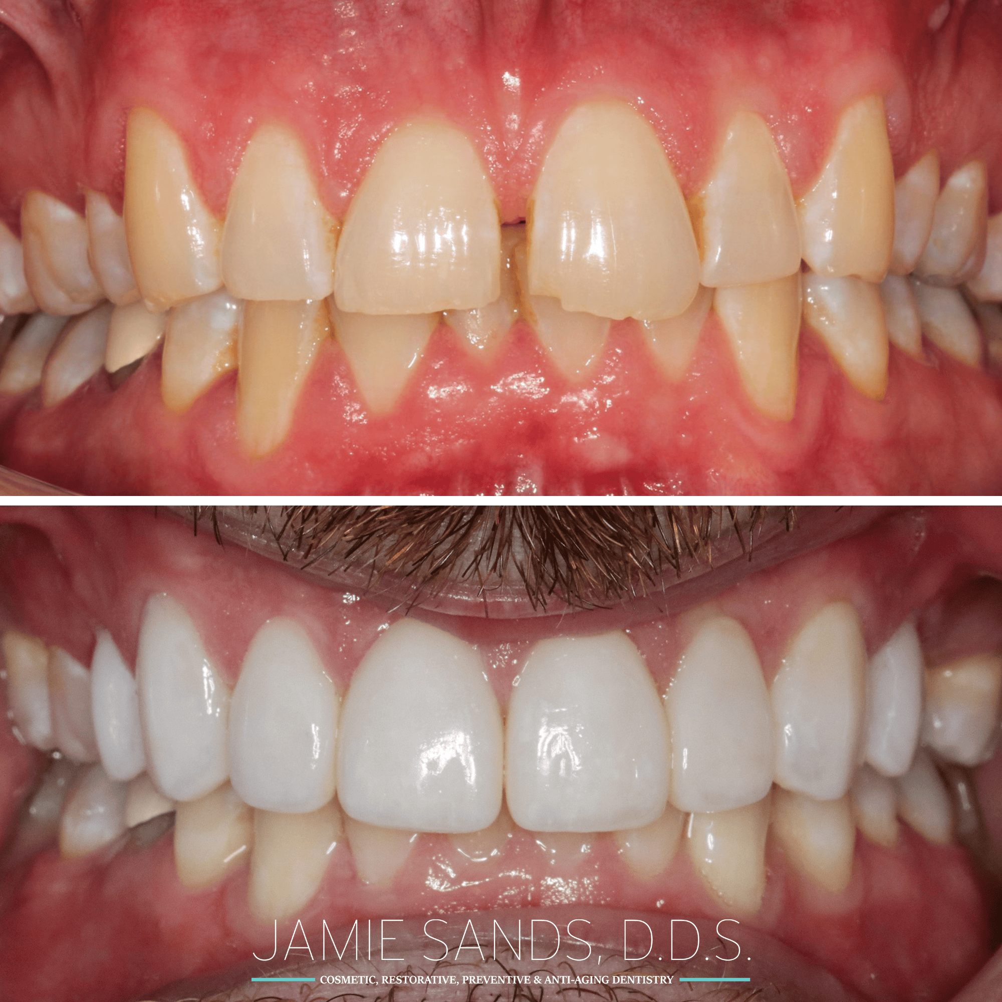 before-after-23