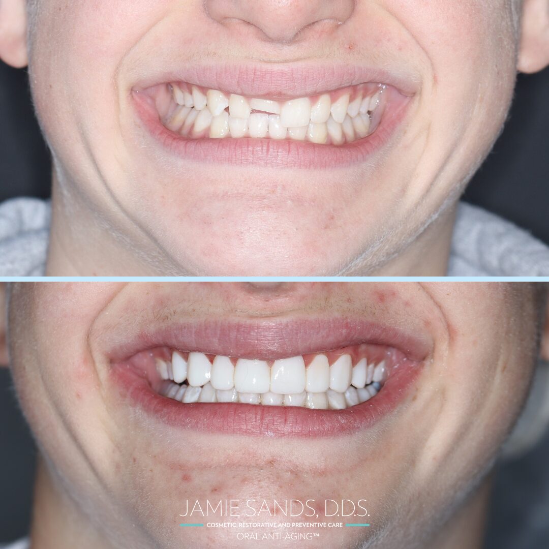 before-after-32